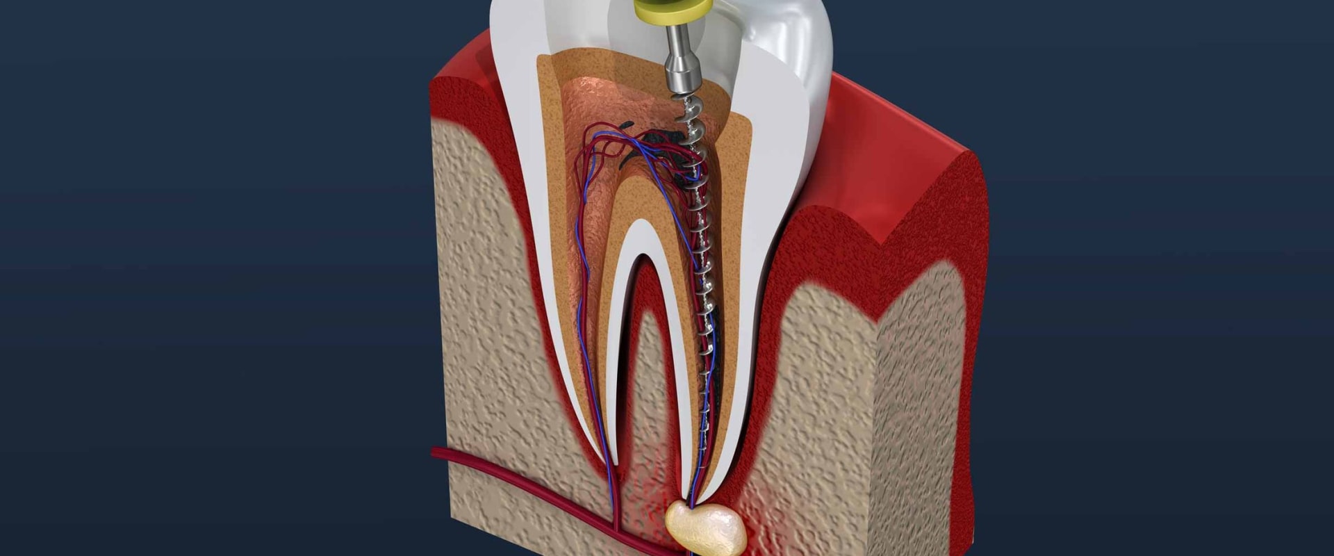 Do endodontists do more than root canals?