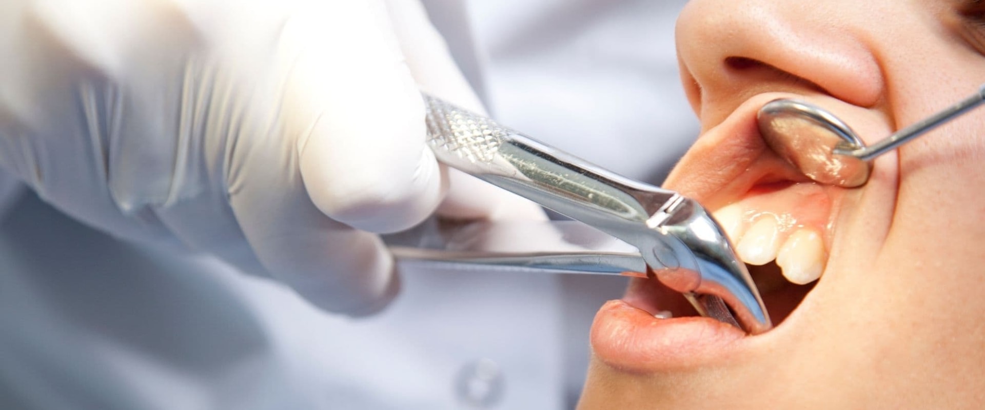 Can an endodontist perform an extraction?