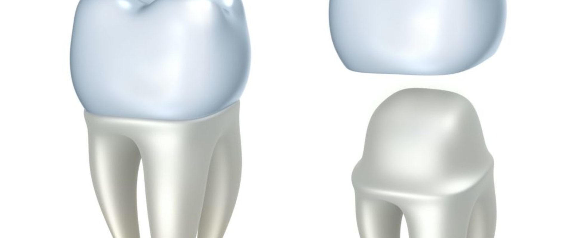 Do endodontists do temporary crowns?
