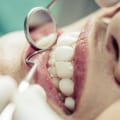 Should I See a Dentist or an Endodontist?