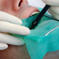 What Does an Endodontist Do During a Root Canal Treatment?