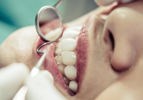Should i see a dentist or an endodontist?