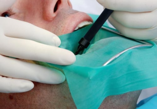What does an endodontist do during a root canal?